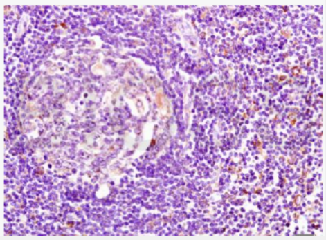 Anti-MHC Class II antibody-组织相容性复合体β（HLA-DMB）抗体