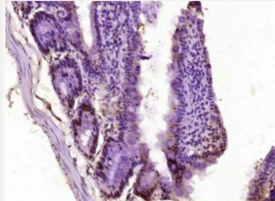 Anti-phospho-AMPK alpha-1 (Ser184) antibody-磷酸化腺苷单磷酸活化蛋白激酶α1抗体