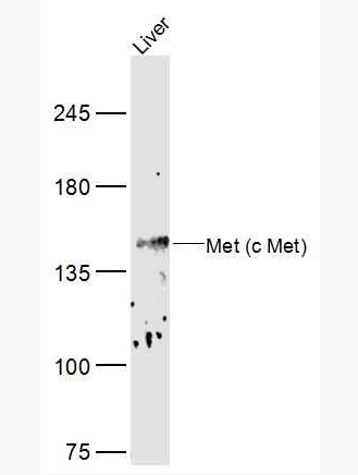 Anti-MET antibody-肝细胞生长因子受体抗体