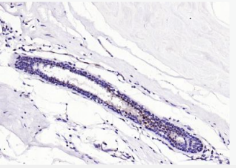 Anti-S100A8+A9 Complex antibody-S100A8+A9 Complex单克隆抗体