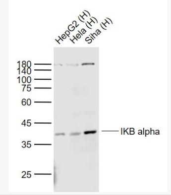 Anti-IKB alpha antibody-核因子κB抑制蛋白α单克隆抗体