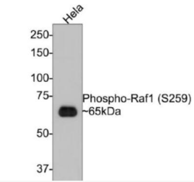 Anti-phospho-RAF1 (Ser259) antibody-磷酸化原癌基因RAF1重组兔单抗