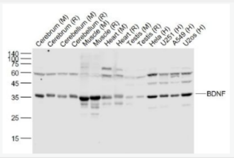 Anti-BDNF antibody-脑源神经营养因子重组兔单抗