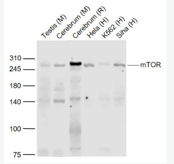 Anti-mTOR  antibody-雷帕霉素靶蛋白重组兔单抗