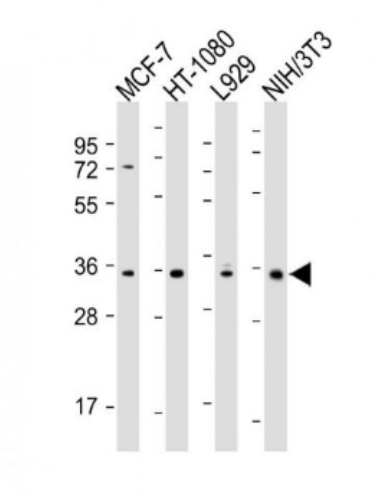 Anti-CCND1  antibody-周期素D1单克隆抗体