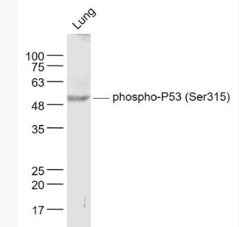 Anti-phospho-P53 (Ser315) antibody-磷酸化肿瘤抑制基因P53抗体