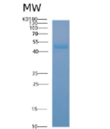 Recombinant Human ACADS Protein