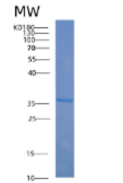 Recombinant Human ABO Protein