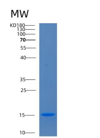 Recombinant Human CD160 Protein