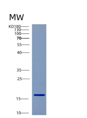 Recombinant Human CST9 Protein