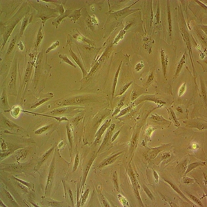 Calu-6人肺退行性癌细胞