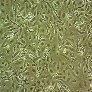 NCI-H441人肺腺癌细胞