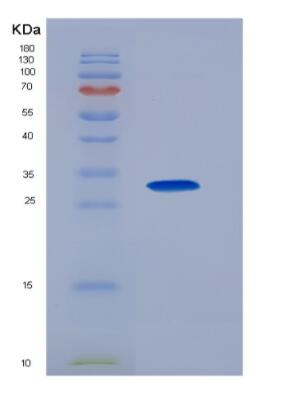 Recombinant Luteinizing Hormone (LH)