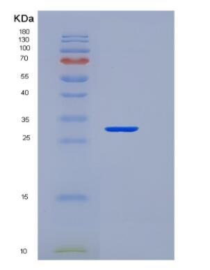 Recombinant Fibroblast Growth Factor 23 (FGF23)