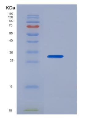 Recombinant Receptor Activator Of Nuclear Factor Kappa B (RANk)