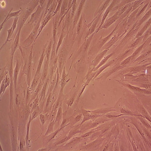 HCT 116人结直肠腺癌细胞