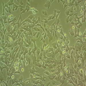 CAOV-3人乳头状卵巢腺癌细胞