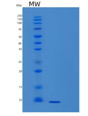 Recombinant Human PTH Protein