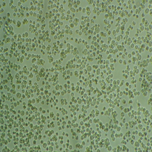 OCI-AML2人急性髓系白血病细胞