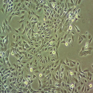 M619人黑色素瘤细胞