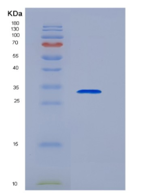 Recombinant Transferrin Receptor (TFR)