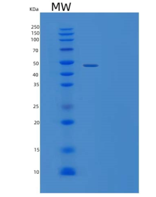 Recombinant Human TNFRSF11A Protein