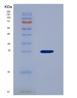 Recombinant Vascular Endothelial Growth Factor B (VEGFB)