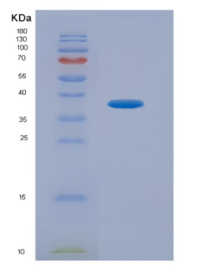 Eukaryotic Programmed Cell Death Protein 1 Ligand 1 (PDL1)