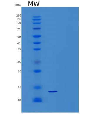 Recombinant Human Serum Amyloid A1/SAA1 Protein(N-6His)