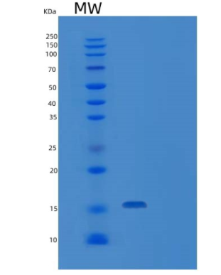 Recombinant Human IFN-gamma / IFNG / γ-IFN Protein