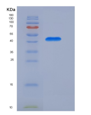 Eukaryotic Cluster Of Differentiation 8b (CD8b)