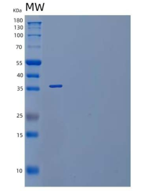 Recombinant Mouse IL-1 Receptor-Like 1/IL-1RL1/IL-1 R4 Protein(C-6His)