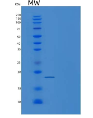 Recombinant Mouse bFGF / FGF2 Protein (His Tag)