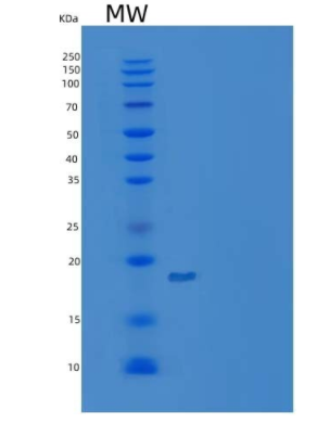 Recombinant Human Stem Cell Factor/SCF/c-Kit Ligand Protein