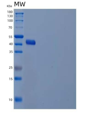 Recombinant Human Alcohol Dehydrogenase Class 4 Mu/ADH7 Protein(C-6His)