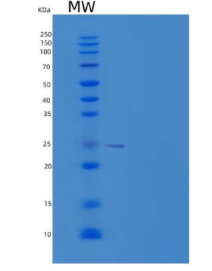 Recombinant Human Thymidylate Kinase/DTYMK Protein(C-6His)