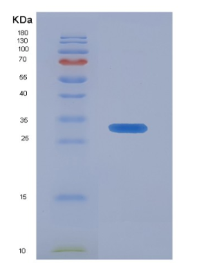 Recombinant Insulin Like Growth Factor 2 mRNA Binding Protein 2 (IGF2BP2)