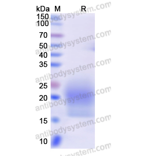 Recombinant Human CSF2/GM-CSF, C-His