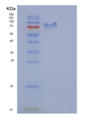 Recombinant Human CD50 / ICAM-3 Protein (His & Fc tag)