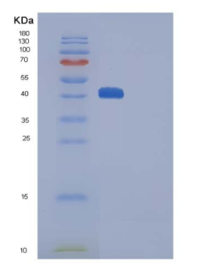 Recombinant Human CTLA4 / CD152 Protein (His & Fc tag)