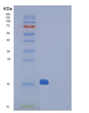 Recombinant Mouse CTLA4 / CD152 Protein (His tag)