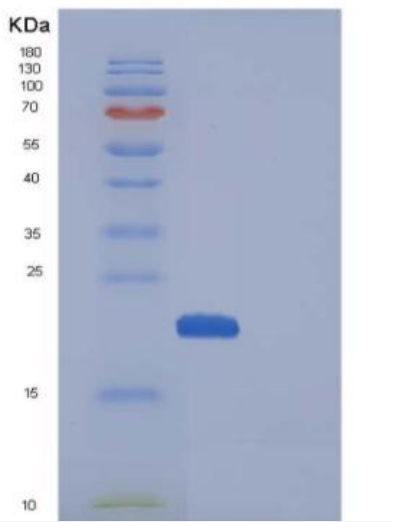 Recombinant Mouse CDNF / ARMETL1 Protein (His tag)