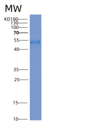 Recombinant Mouse ICAM-1 / CD54 Protein (His tag)