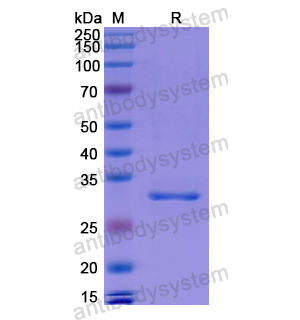 Recombinant Human C1S, N-His