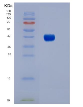 Eukaryotic Fc Fragment Of IgG Low Affinity IIIb Receptor (FcgR3B)