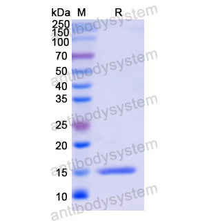 Recombinant Human VCL, N-His