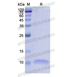 Recombinant Human CXCL2/GRO-beta/MIP2-alpha, N-His