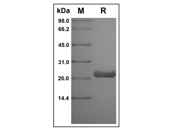 aladdin 阿拉丁 rp155196 Recombinant Rat Prolactin Protein Animal Free, >98%(SDS-PAGE), Active, E.coli, No tag, 30-226 aa