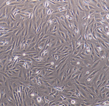 人乳腺癌细胞+GFP（三阴性）MDAMB231/GFP