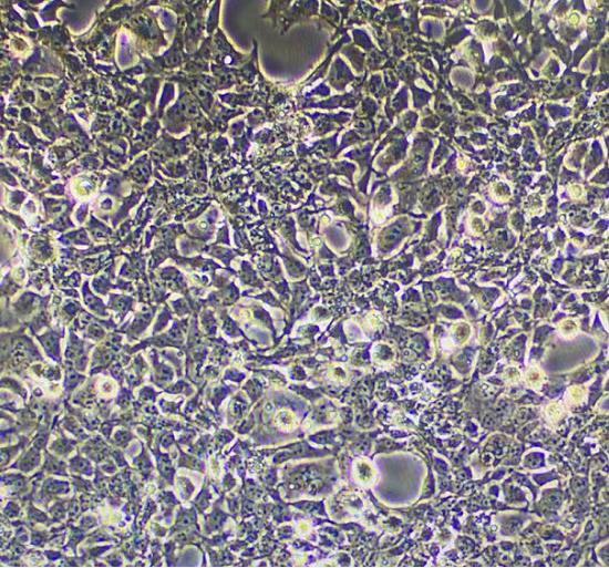 人甲状腺乳头状癌细胞TPC1